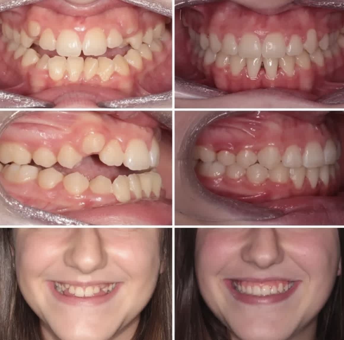 ortodoncia en alameda resultados